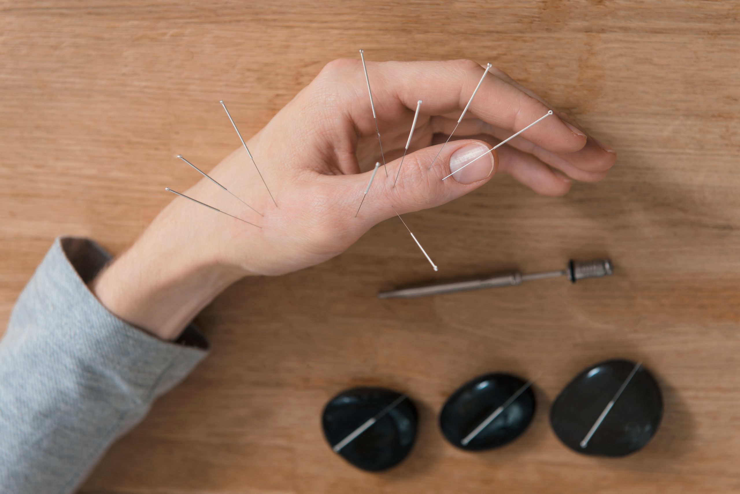 Florida Board of Acupuncture: How to Respond to a DOH Complaint